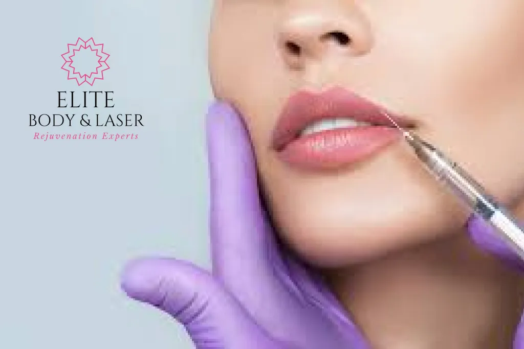 Dermal Fillers