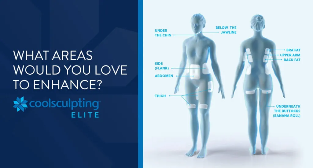 diagram COOLSCULPTING MAP OF TREATMENT AREAS.