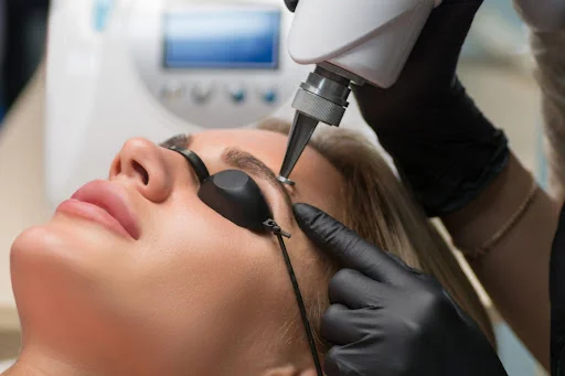 Eyebrow Tattoo Removal by Elite Body and Laser in Lewis Center, OH