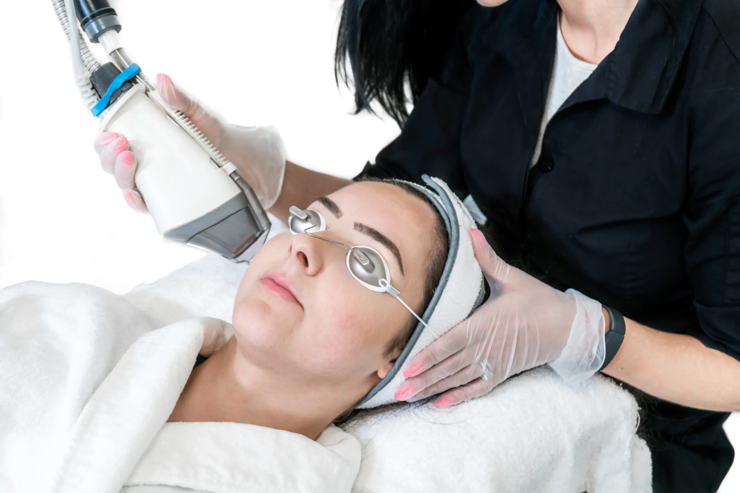 Fraxel for Wrinkles in Lewis Center, OH by Elite Body & Laser