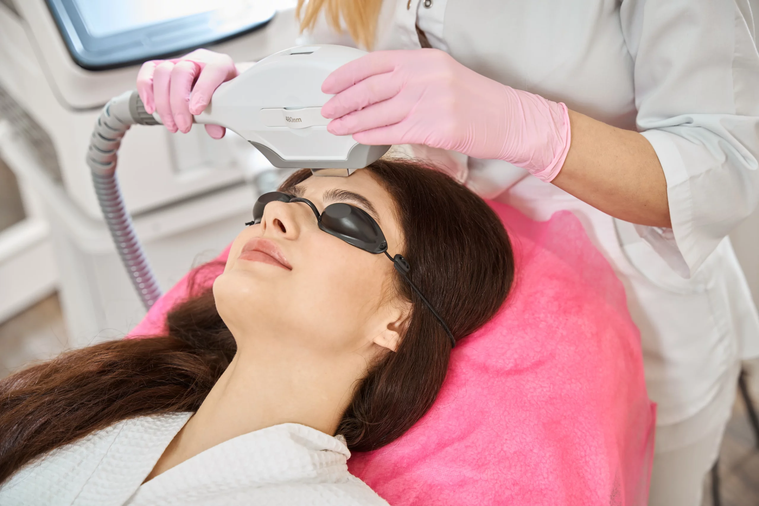 IPL Photofacial