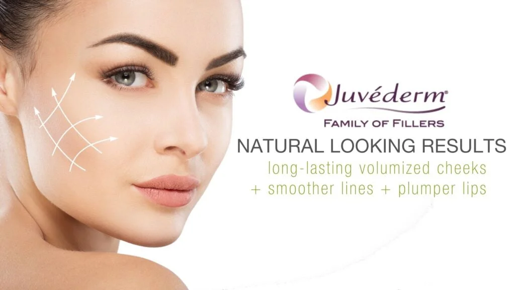 Juvederm Filler in Lewis Center, OH by Elite Body & Laser