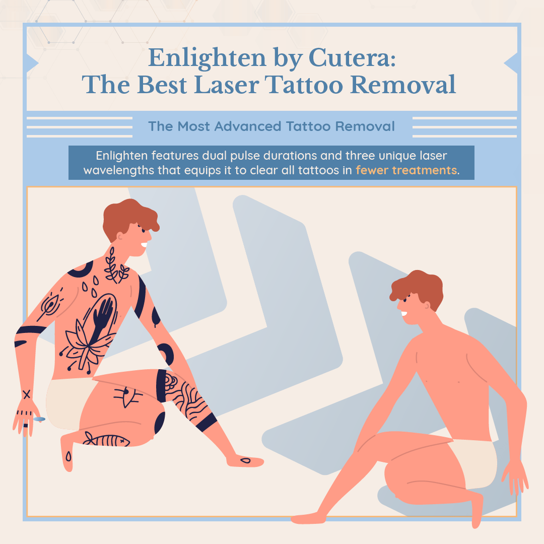 Cosmetic Med Solutions - CUTERAs enlighten has made tattoo regret a thing  of the past. If you are looking for the best laser to remove unwanted  tattoos, ask your doctor about Enlighten