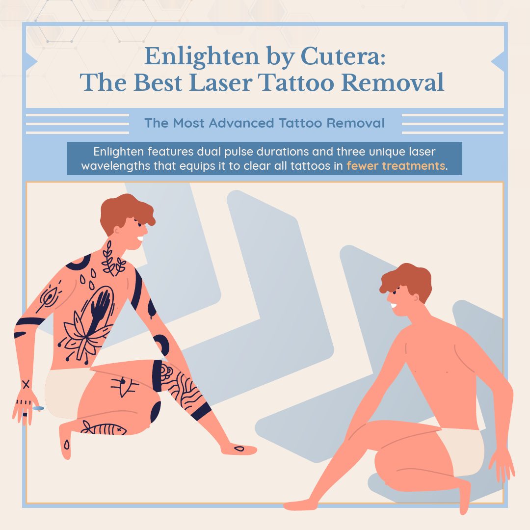 Enlighten By Cutera: The Best Laser Tattoo Removal (How It Works