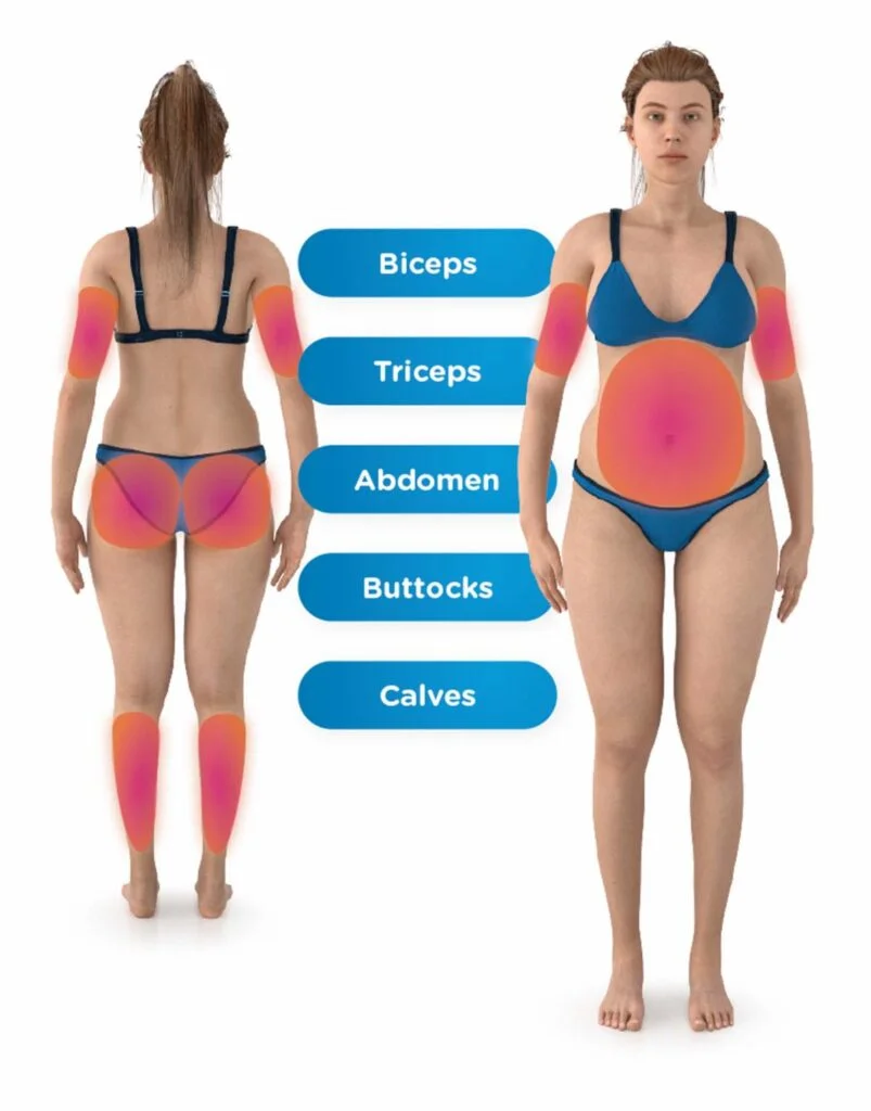 Deep Aesthetics - The Emsculpt NEO : For Diastasis Recti + Other Ab  Separation Treatments 🤩🤩🤩 Reconstriuctive surgery, physical therapy, and  Emsculpt NEO for diastasis recti are all effective treatments for abdominal