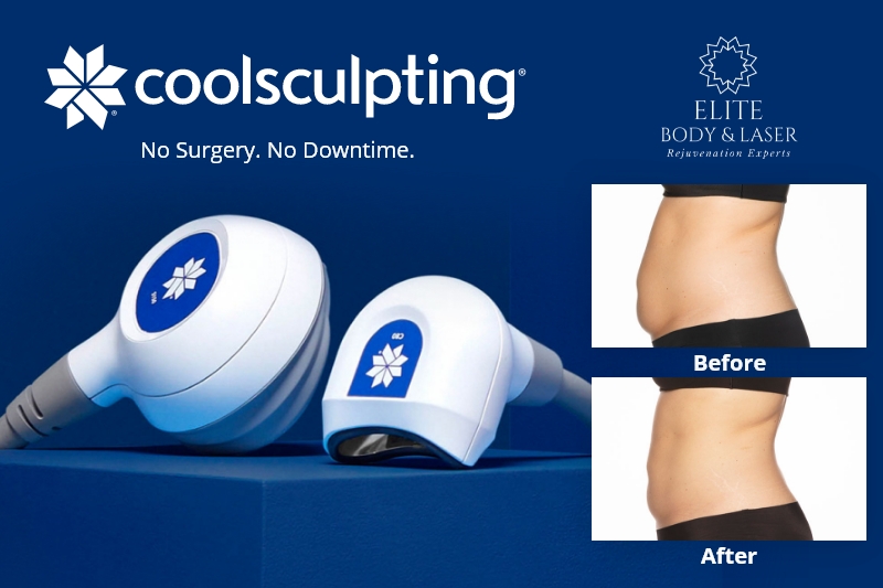 custom graphic showing before after results of coolsculpting columbus ohio