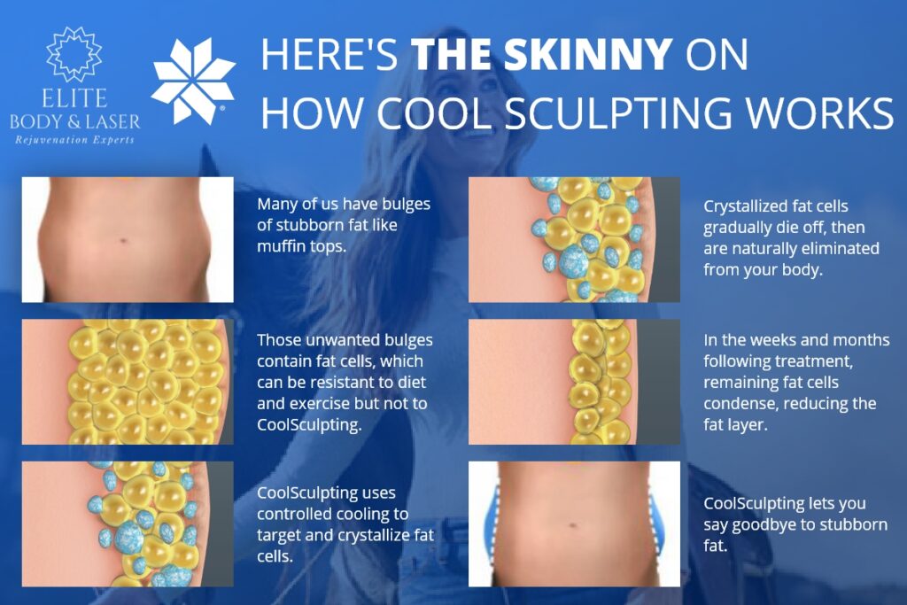 how-coolsculpting-works