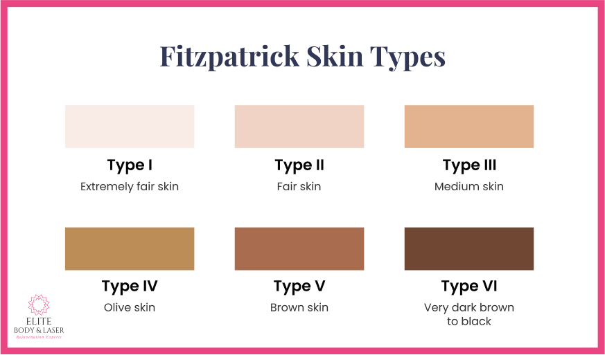 Fitzpatrick Skin Types
