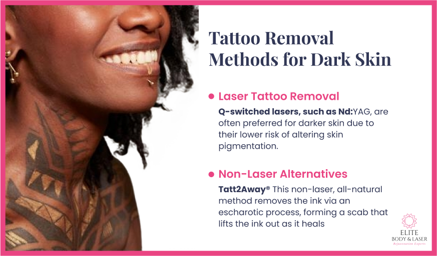 Tattoo Removal Methods for Dark Skin