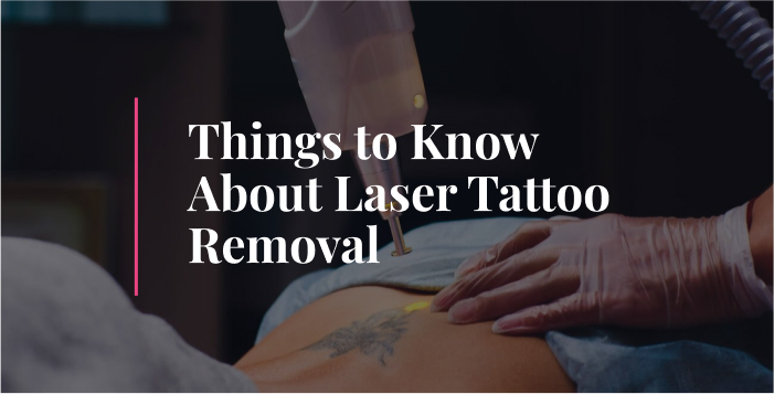 Things to Know About Laser Tattoo Removal