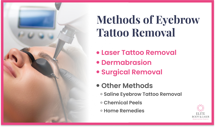 Methods of Eyebrow Tattoo Removal