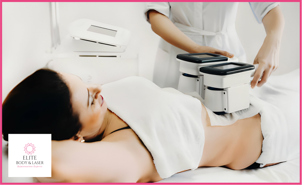 Photo of a CoolSculpting session in progress, with a person comfortably undergoing the non-invasive fat reduction treatment. The specialized device is positioned on the targeted area, using controlled cooling technology to contour the body.