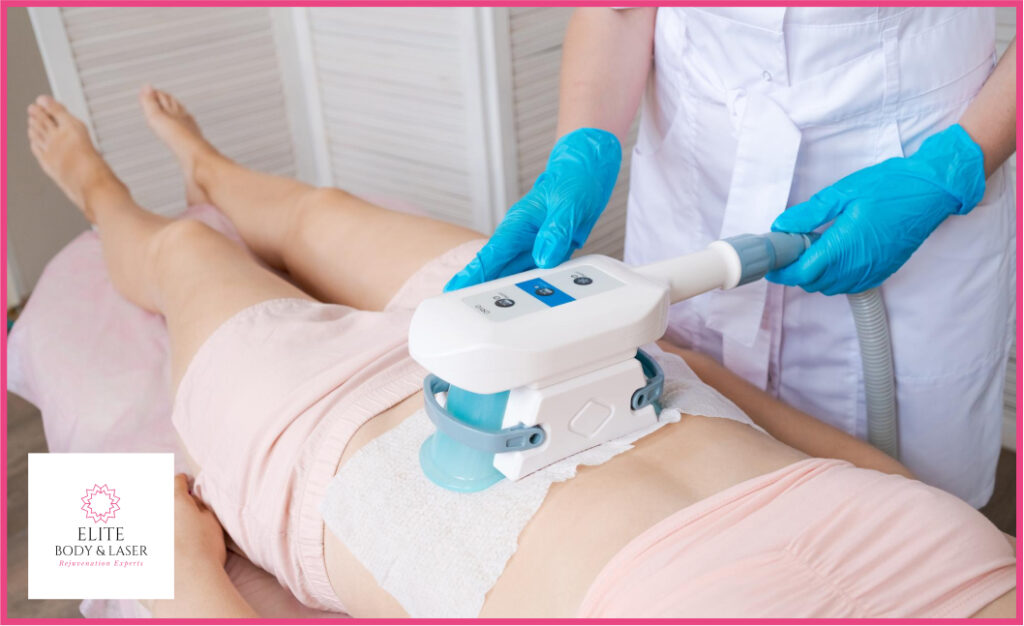 An image showcasing CoolSculpting treatment, a non-invasive fat reduction procedure. The photo depicts a person undergoing the procedure with specialized equipment targeting areas for fat freezing.