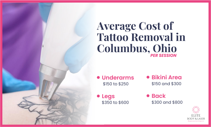 Average Cost of Tattoo Removal