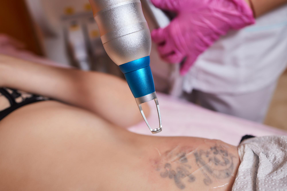 young-woman-undergoing-laser-tattoo-removal-procedure-salon-closeup