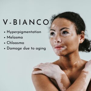 V-BIANCO