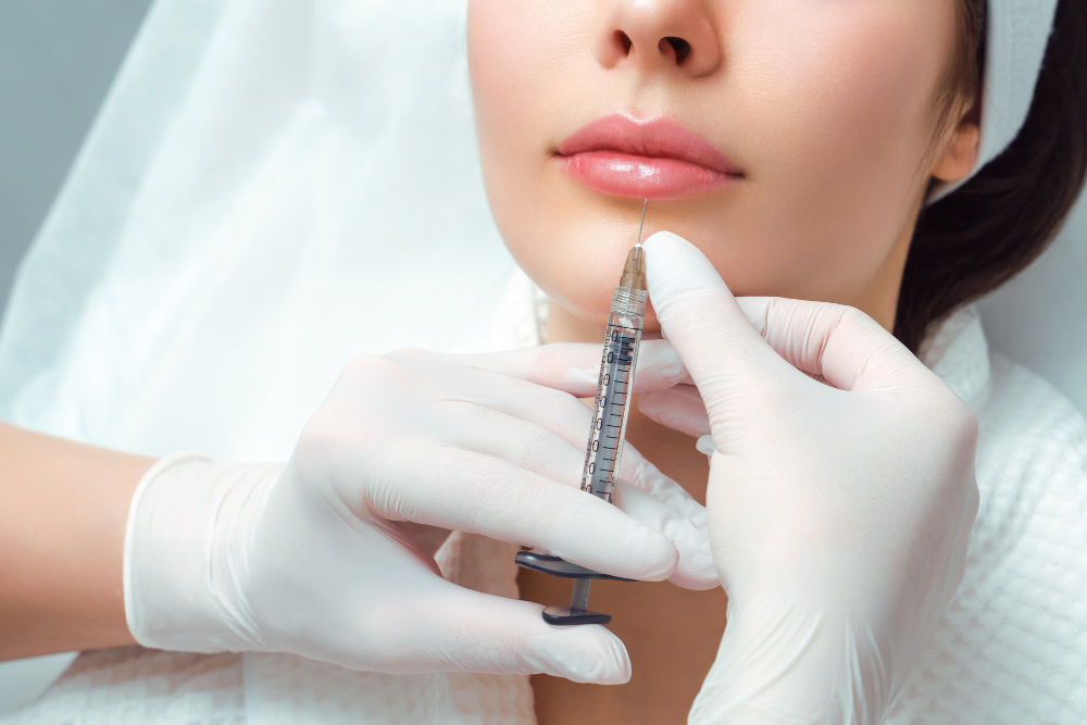 "Close-up of a woman's face receiving a dermal filler injection below the lips from a gloved professional, highlighting the treatment area around the lower lip and chin.