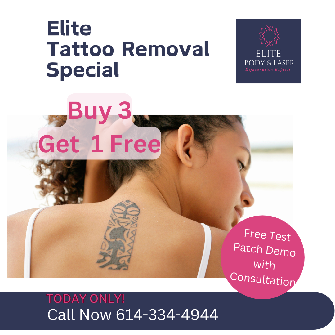 Tattoo removal txt promo (Instagram Post)