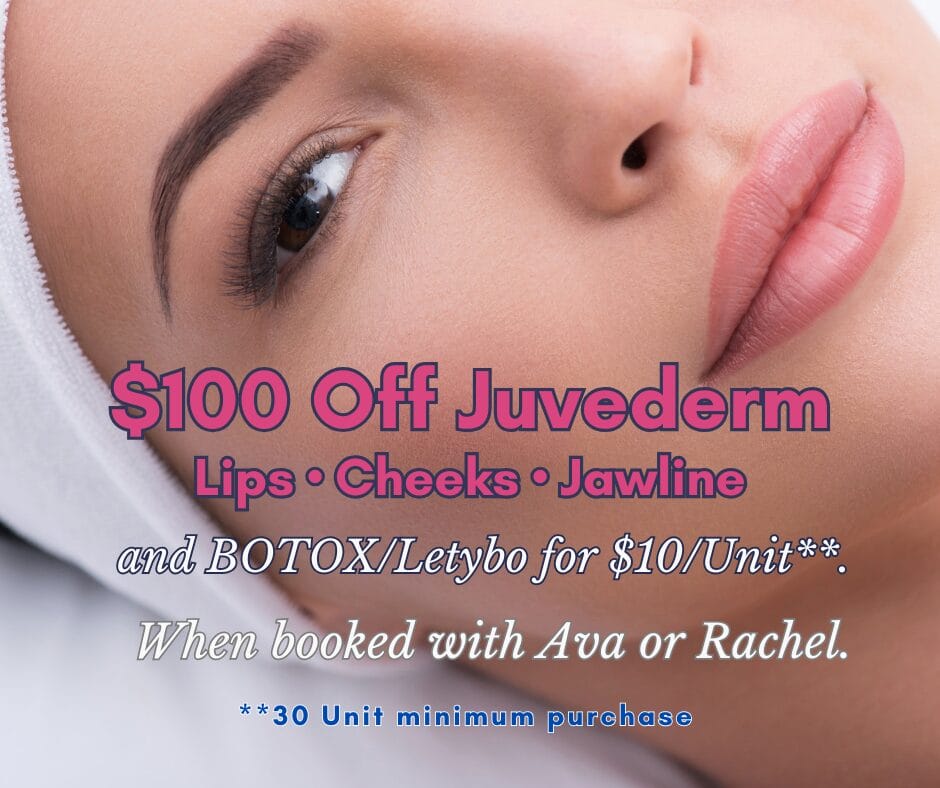 Juvederm for Lips (Facebook Post) (2)