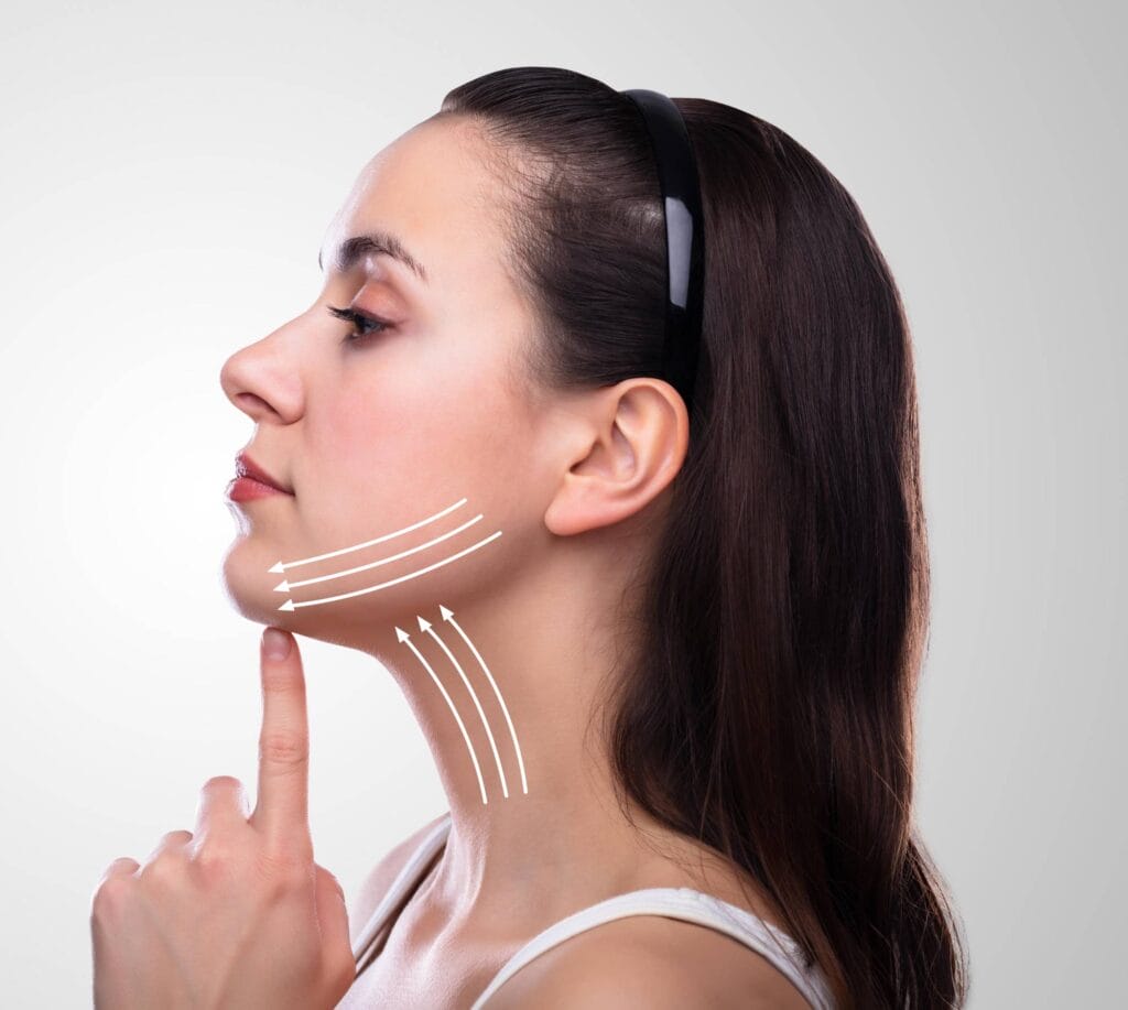 woman-after-face-lifting-her-face