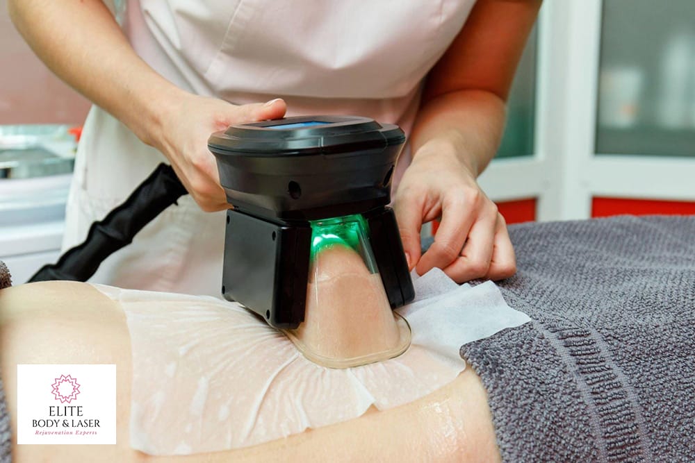 coolsculpting-operation